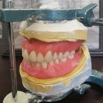 Beautiful Dentures Now Offered