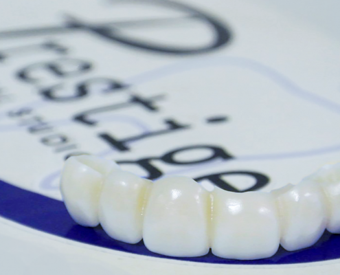 Teeth on Prestige Logo